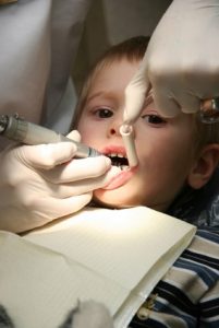 pediatric dental sealants Mission Viejo CA